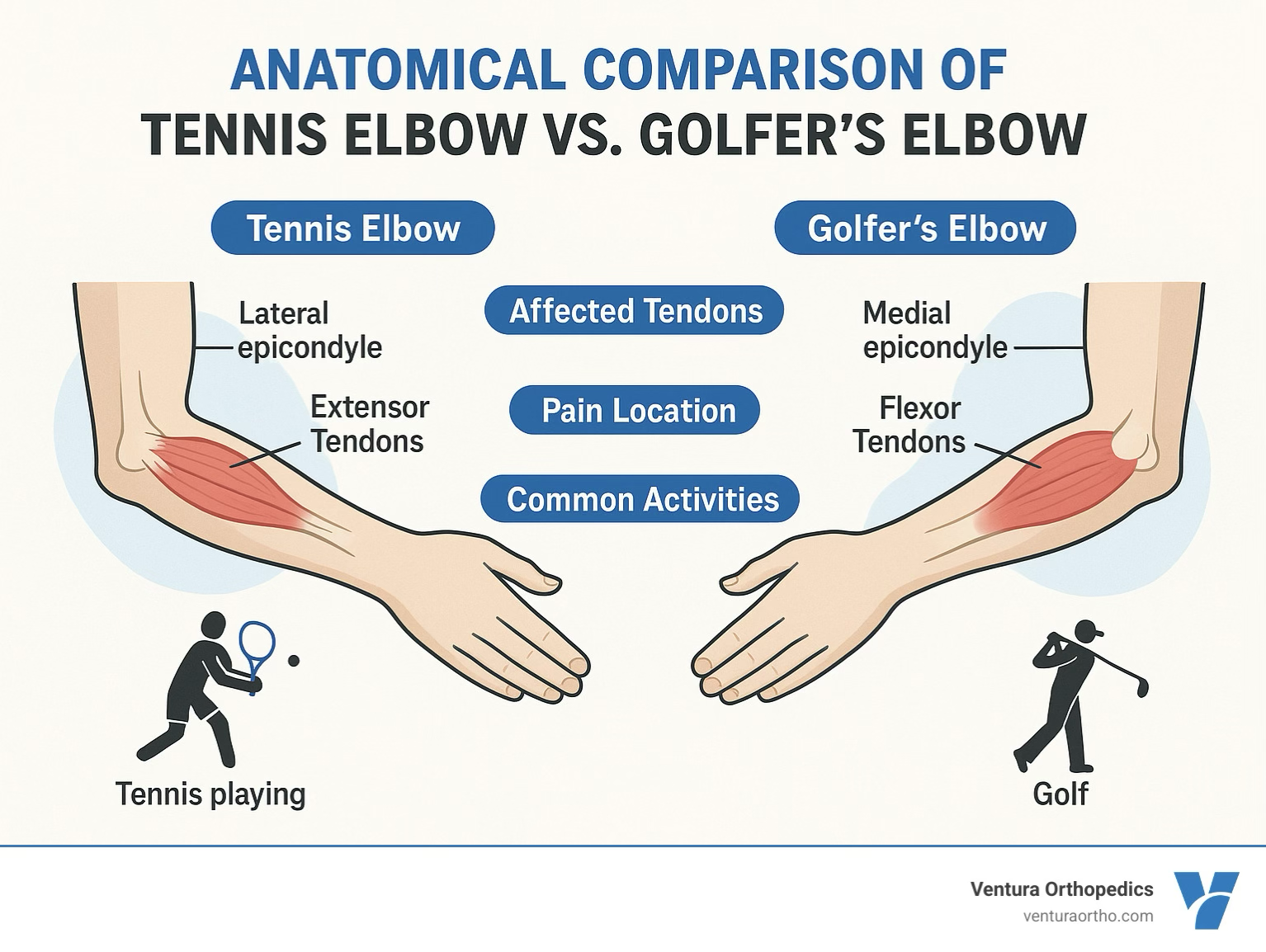 <p>symptoms of lateral &amp; medial epicondylitis </p>