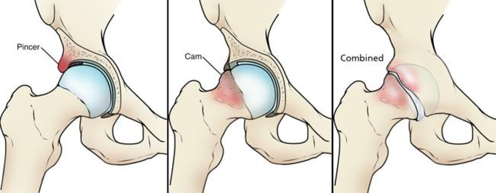 <p>What injury / condition? </p>