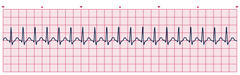 <p>identify the rhythm</p>