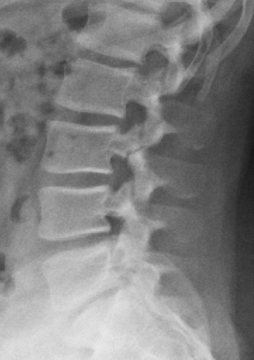 <p>What is the finding, Dx, and follow up?</p>