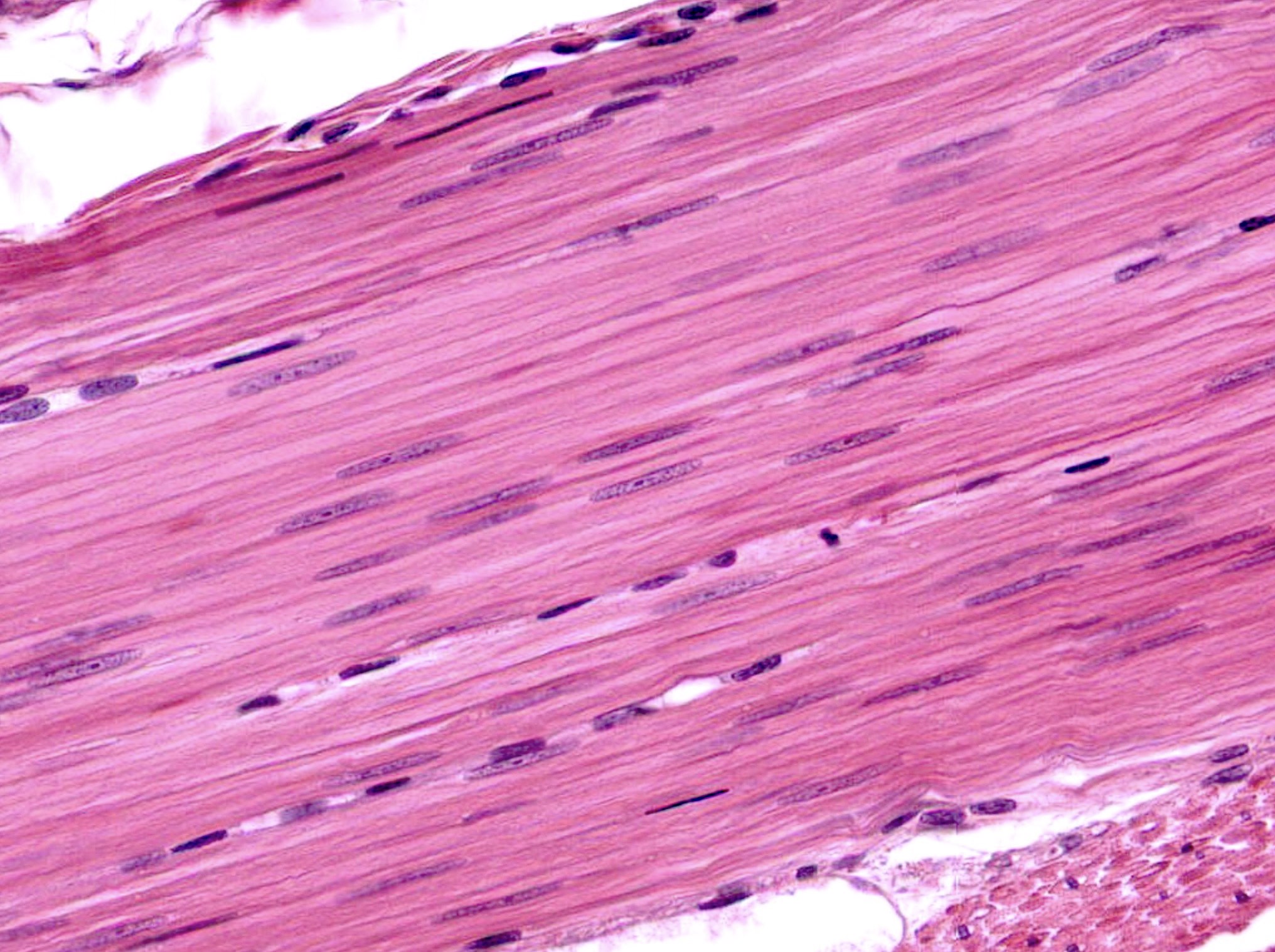 <p>long cell with tapered edge, central nucleus, no cross striations, has cartilage between cells</p>