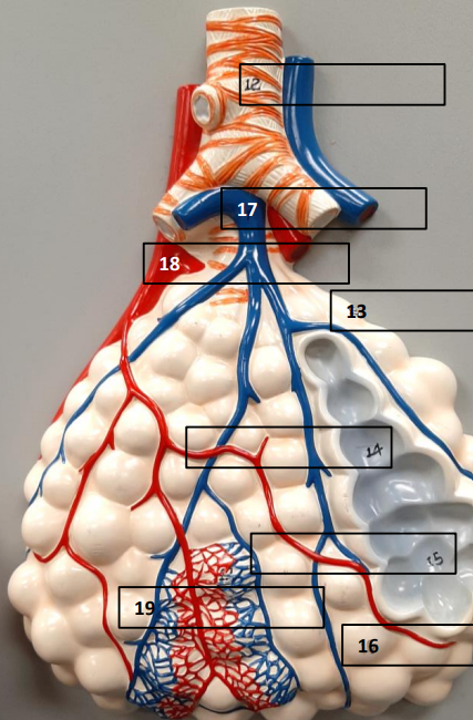 <p>Label this image.</p>