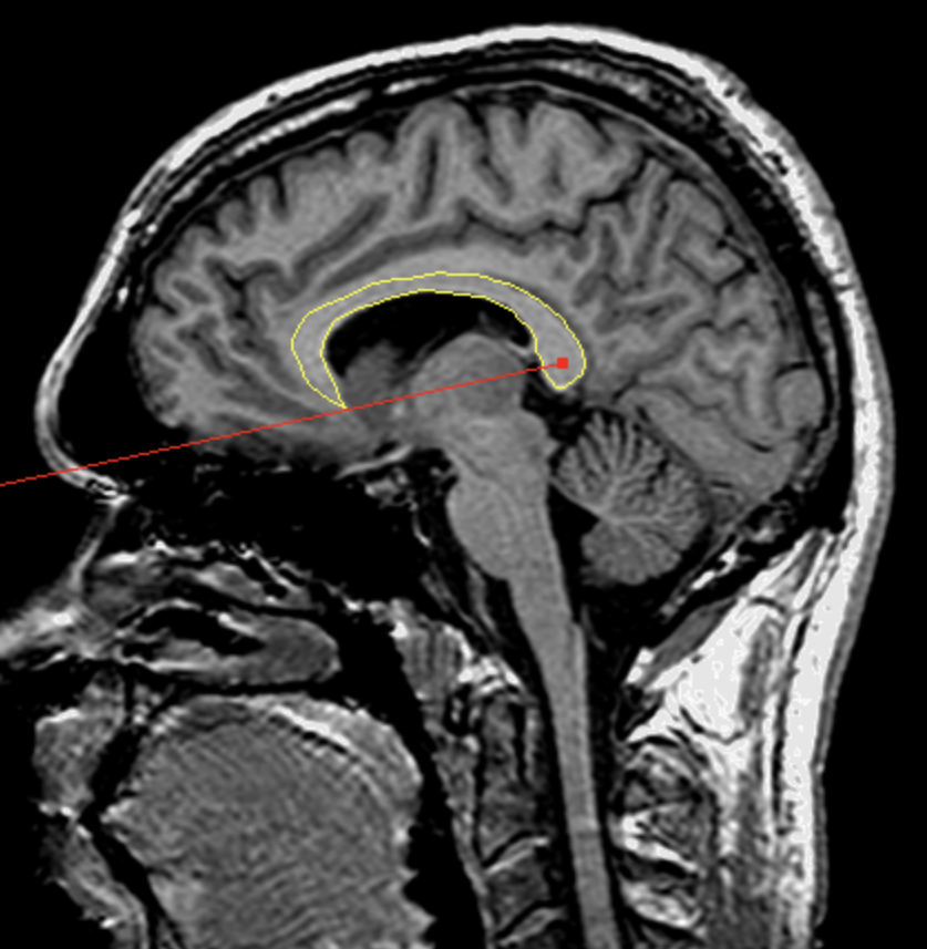 <p>What is the area highlighted called?</p>