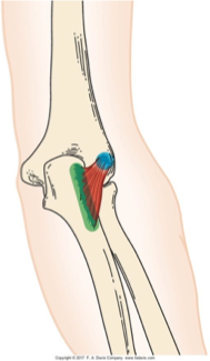 <p>weak elbow extensor </p><p></p><p>ex: casting fishing line, throwing a ball </p>