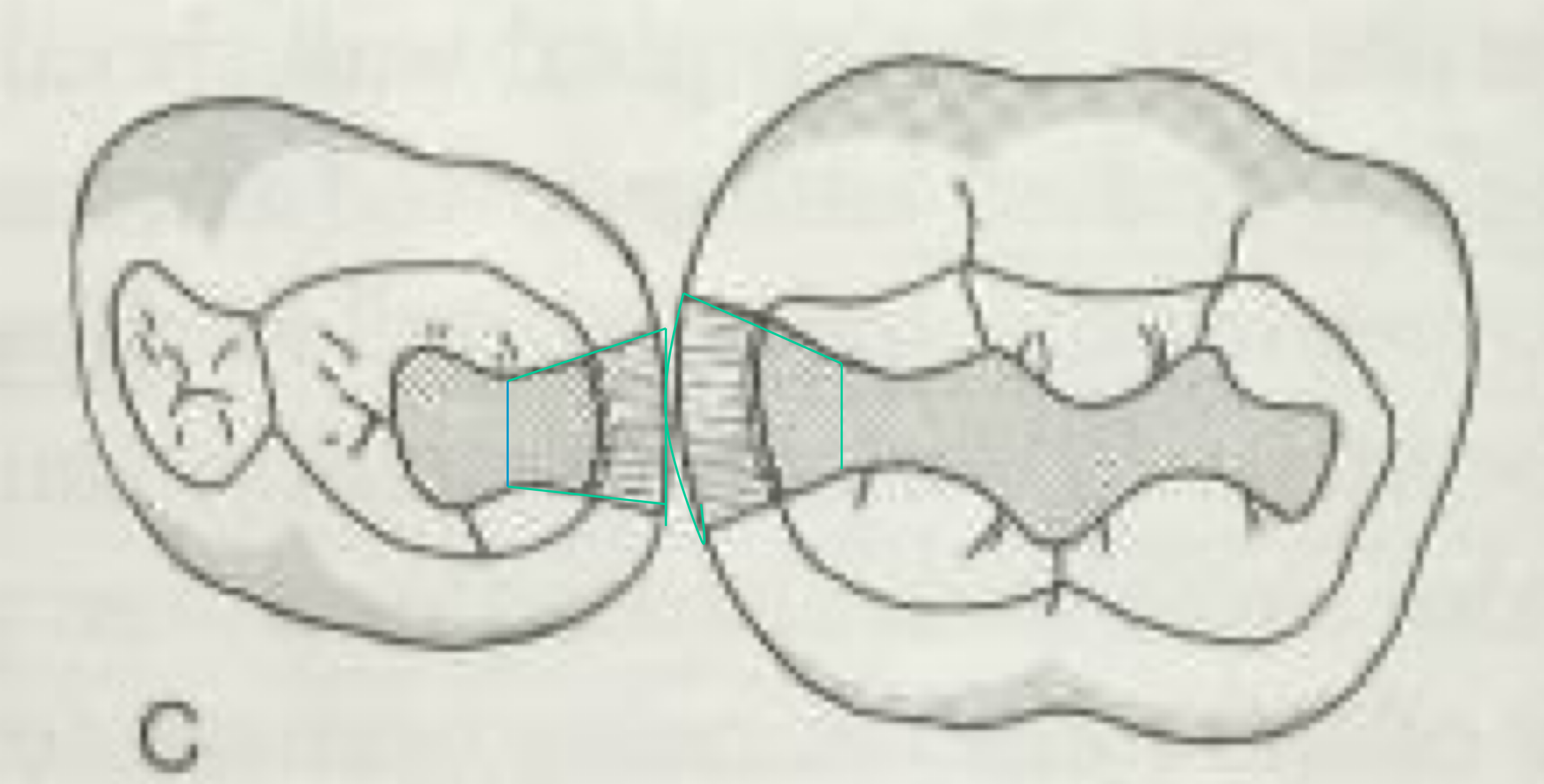 <p>which is the amalgam surface? composite?</p>