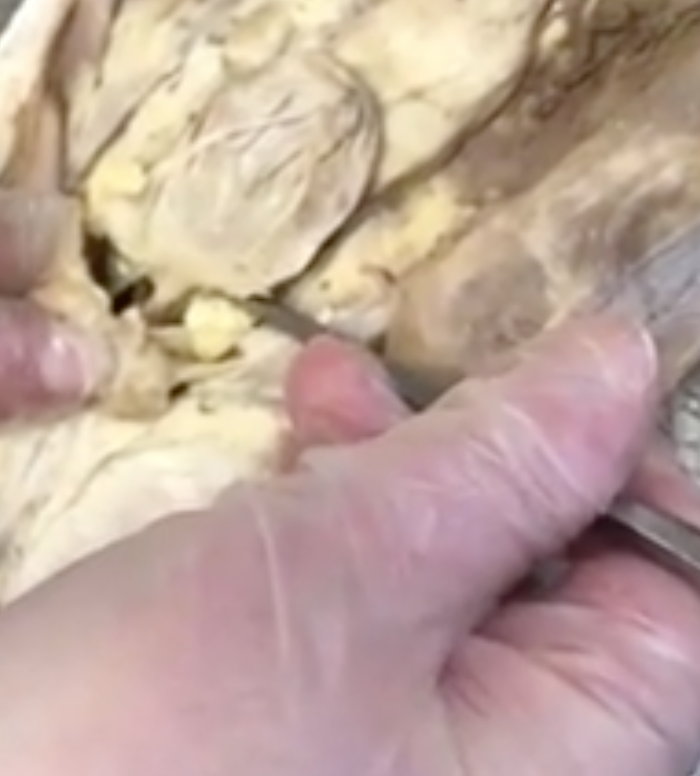 <p>what is the canal coming out of the bottom of the bladder</p>