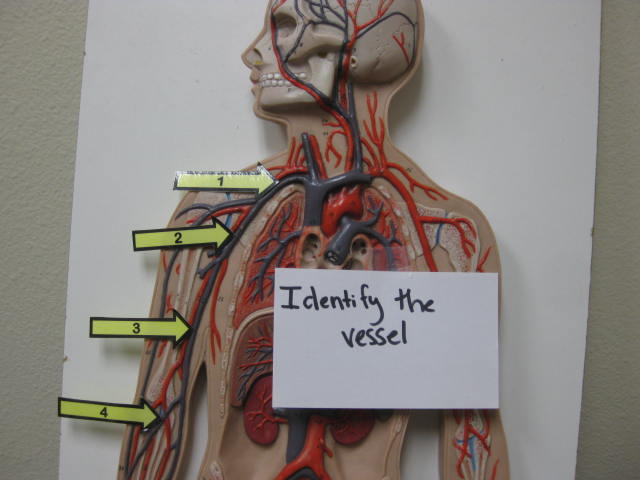 <p>Identify The Vessel 1, 2, 3, and 4?</p><p>Lab Image 3-14</p>