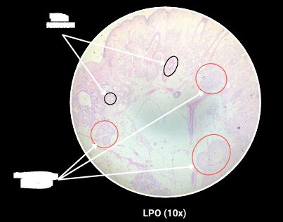 <p>What are the arrows pointing?</p>