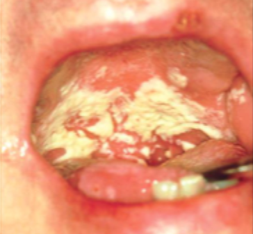 <p>what is this condition</p>