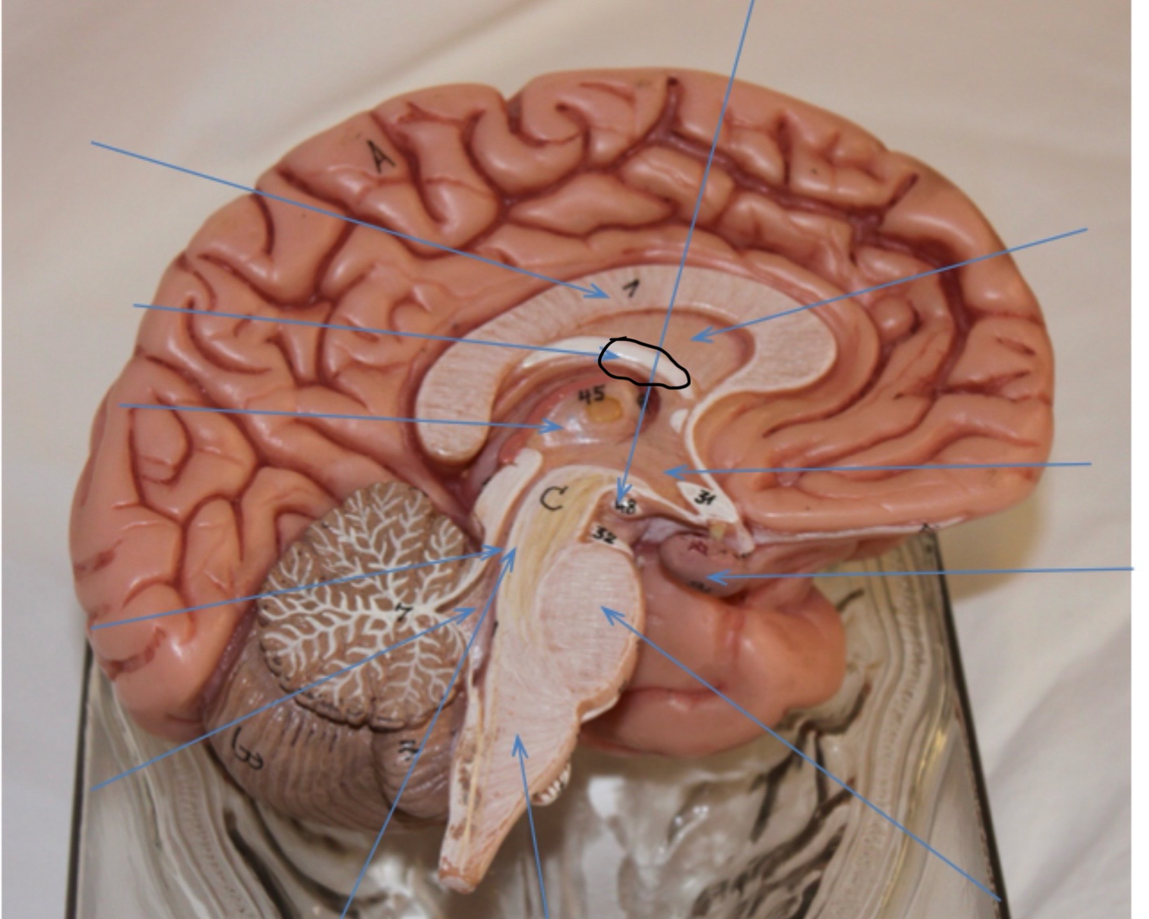 <p>Identify the circled area?</p>