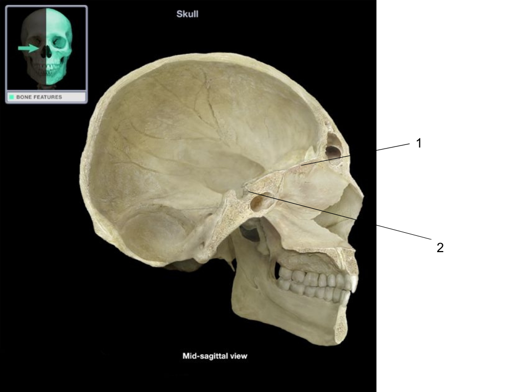 <p>what is #1 pointing at?</p>