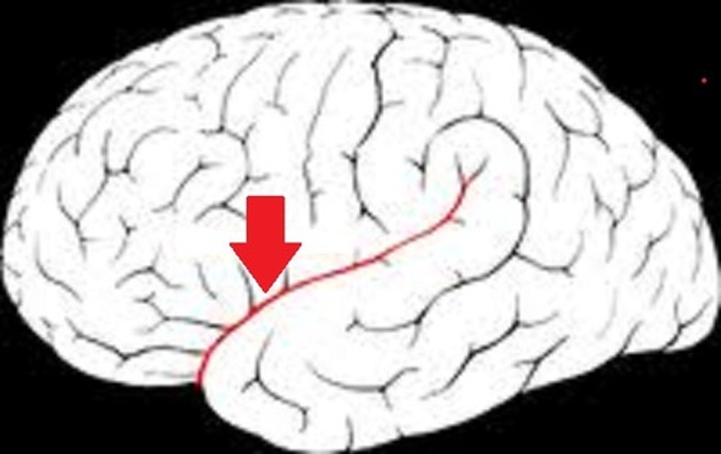 <p>A deep groove separating the temporal lobe from the frontal and parietal lobes.</p>