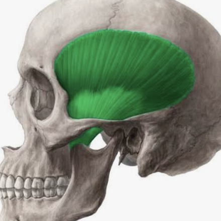 <p>Which muscle is this?</p>