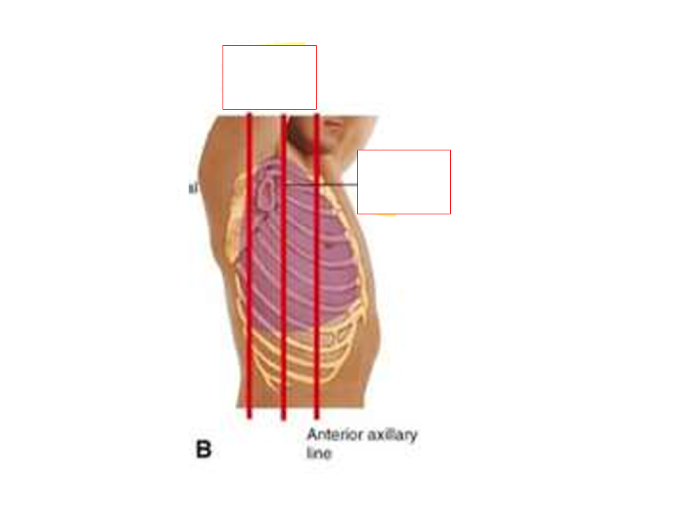<p><strong>What are the posterior reference lines for lung assessment?</strong></p>