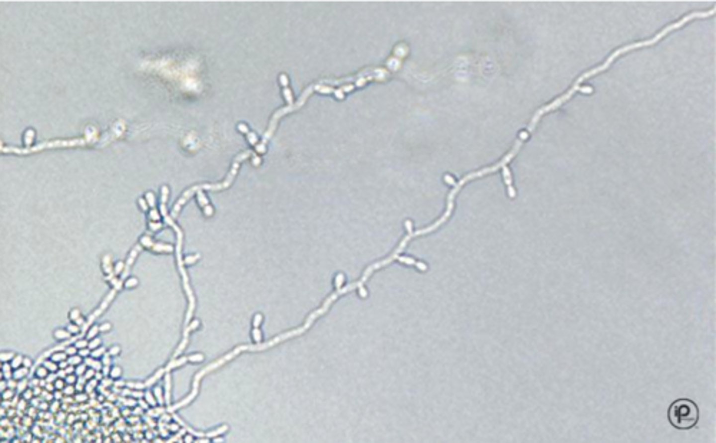 <p>Ovoid or elongate blastoconidia, singly along pseudohyphae at junctions</p><p>May form true junctions</p><p>Birds on a wire</p>