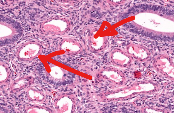term image