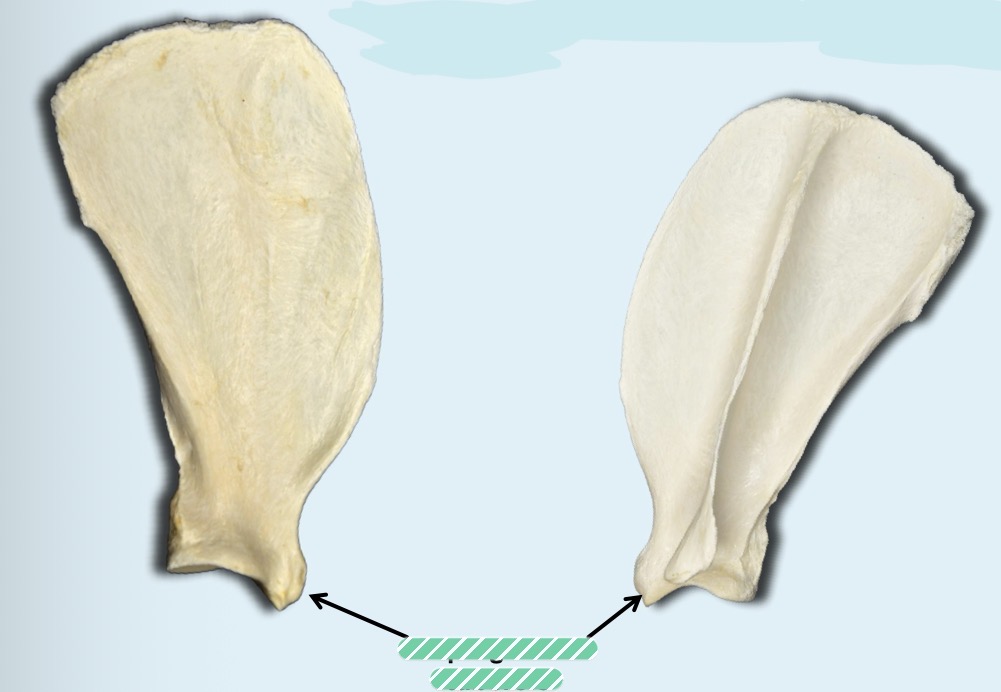 <p>Identify the structure </p>