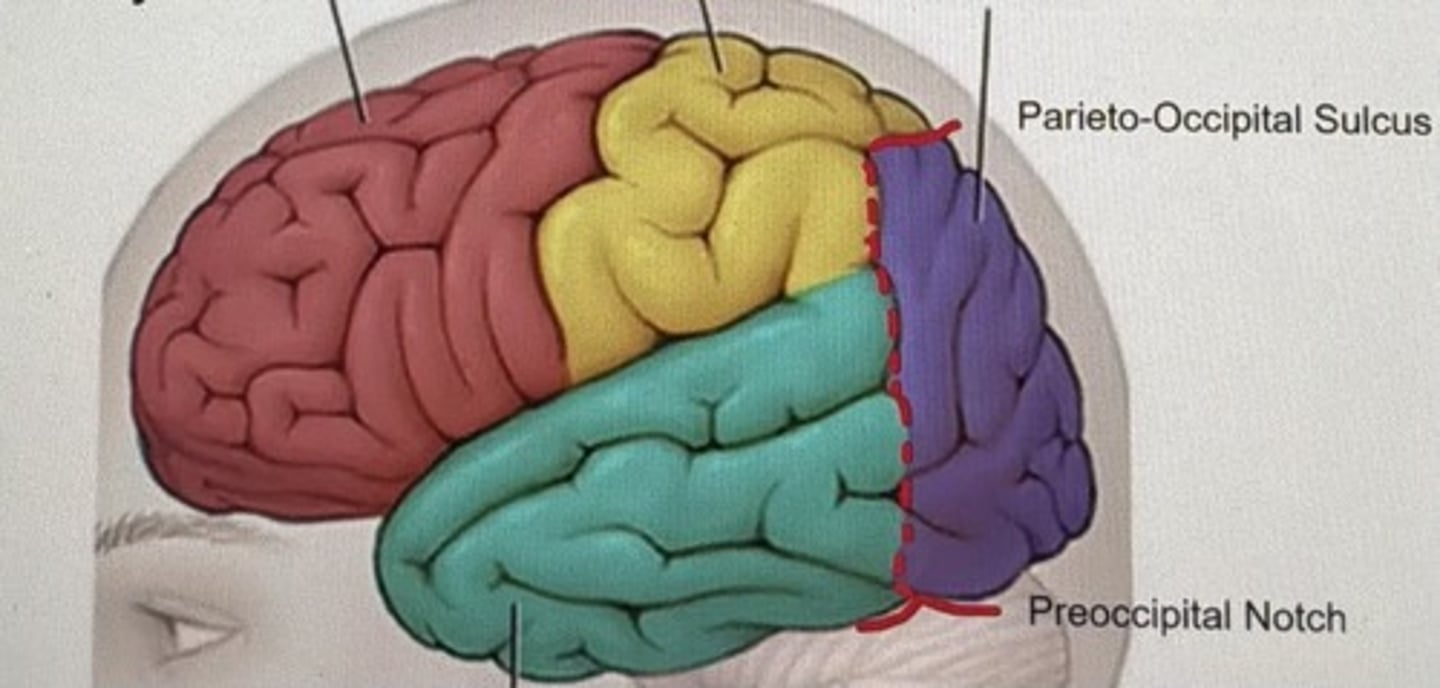 <p>What structures are colored purple?</p>