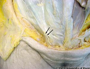 <p>what is the name of the structure that is located superior and lateral to the superfical inguinal ring (shown in image)</p>