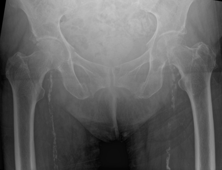 <p>What is the diagnosis?</p>