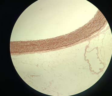 <p>Aorta - Orcein</p><ul><li><p>Orcein stains elastic structure only</p></li><li><p>its a blood vessel, with epithelium (simple squamous epithelium, endothlium)</p></li><li><p>Tunica etimum - contains endothelium</p></li><li><p>Suped utelium - loose connective tissue</p></li><li><p>2 layers:</p><ul><li><p>top: membrana elastica externa</p></li><li><p>inside: tunica media which contains membrana elastica interna</p></li></ul></li><li><p>Tunica adventitia</p></li><li><p>Smooth muscle cells</p></li></ul><p></p>