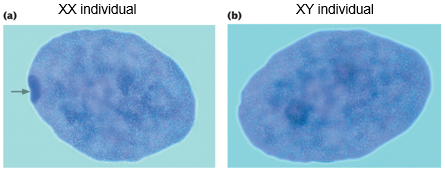 <p>nuclei of XX individuals but not XY, a Barr body is a highly condensed chromosome</p>