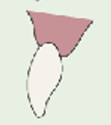 <p>what is the recommended location, advantages, disadvantages, indications, contraindications, and possible materials for an ovate pontic?</p>