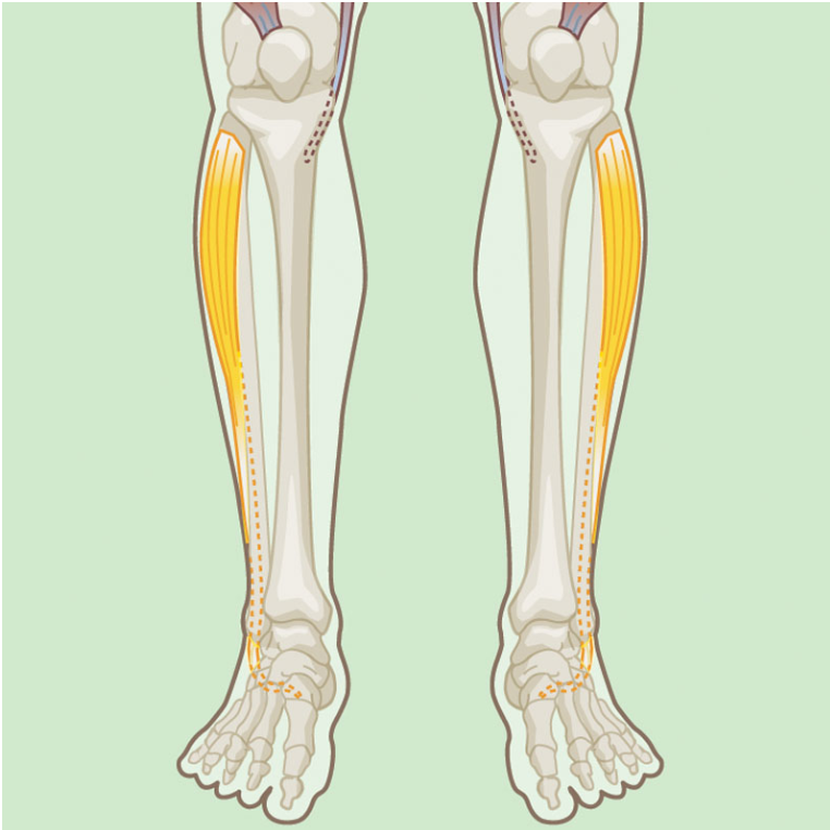 <p>Fibularis (Peroneus) Longus</p>