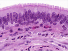 <p>Identify</p>
