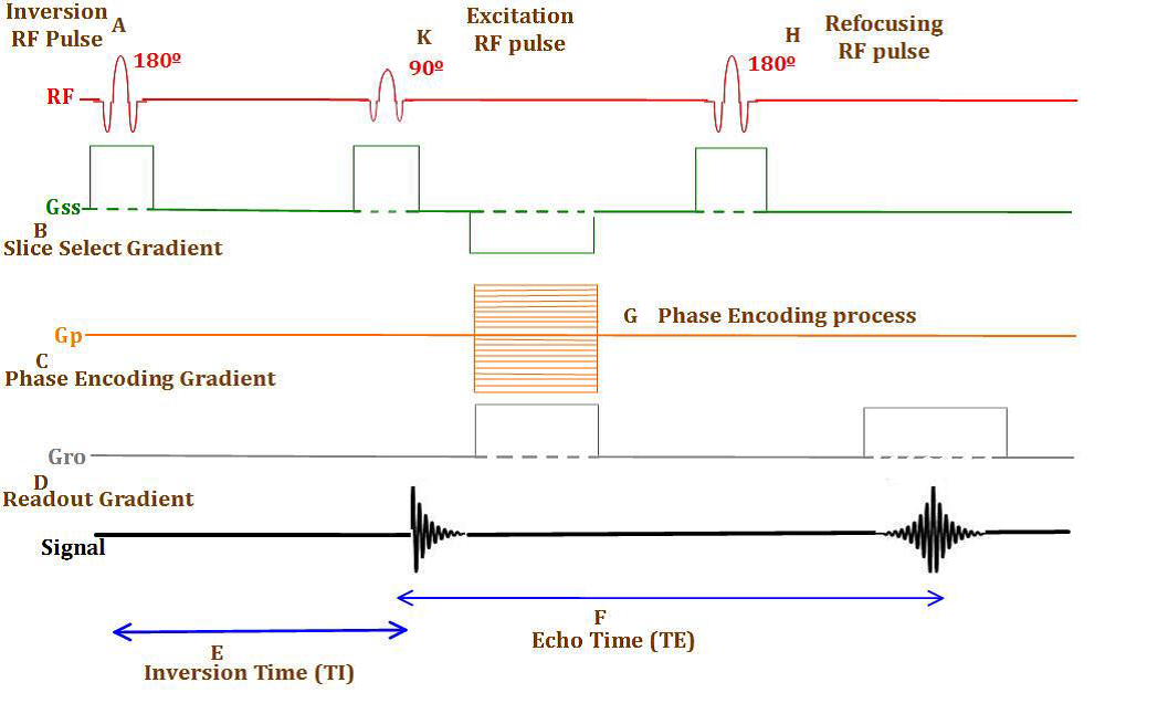 <p>What type of pulse sequence is this ?</p>