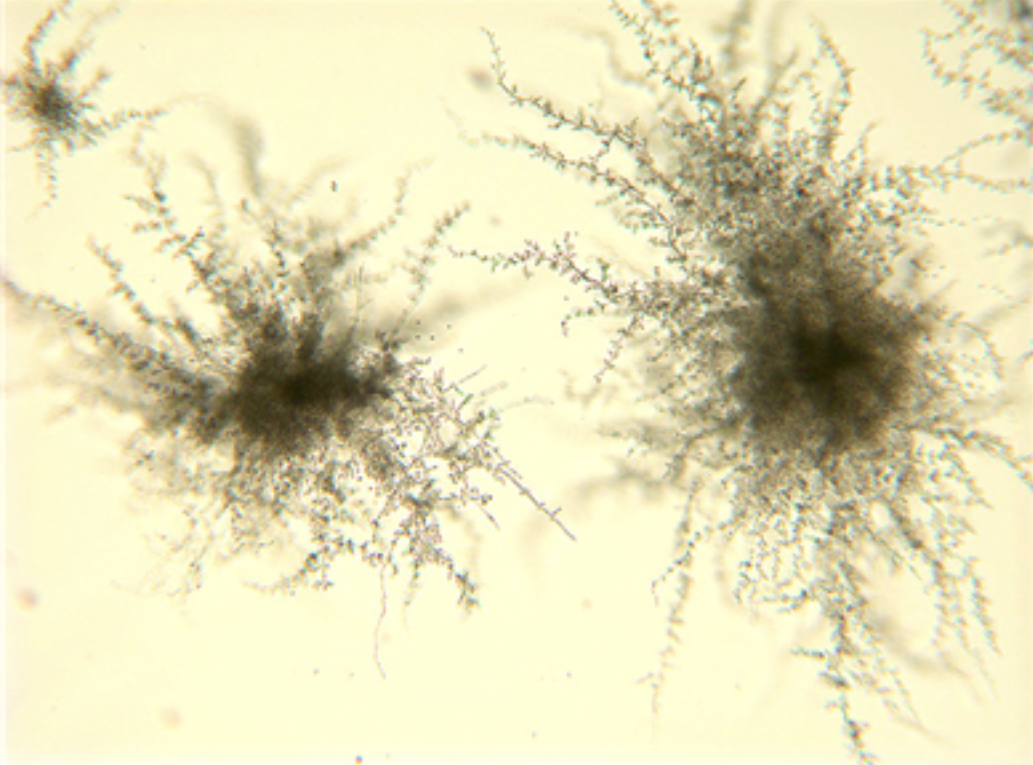 <p>ID the type of yeast </p>