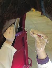 <p>This is *trans tracheal* or *trans endoscopic* tracheal wash</p>