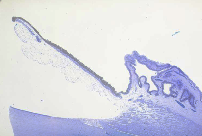 <p>identify the structures of the histology of the filtration angle </p>