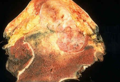 <p>What condition is this?</p>