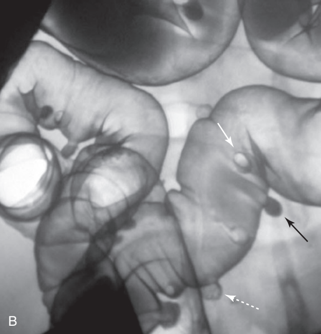 <p>Diagnosis</p>