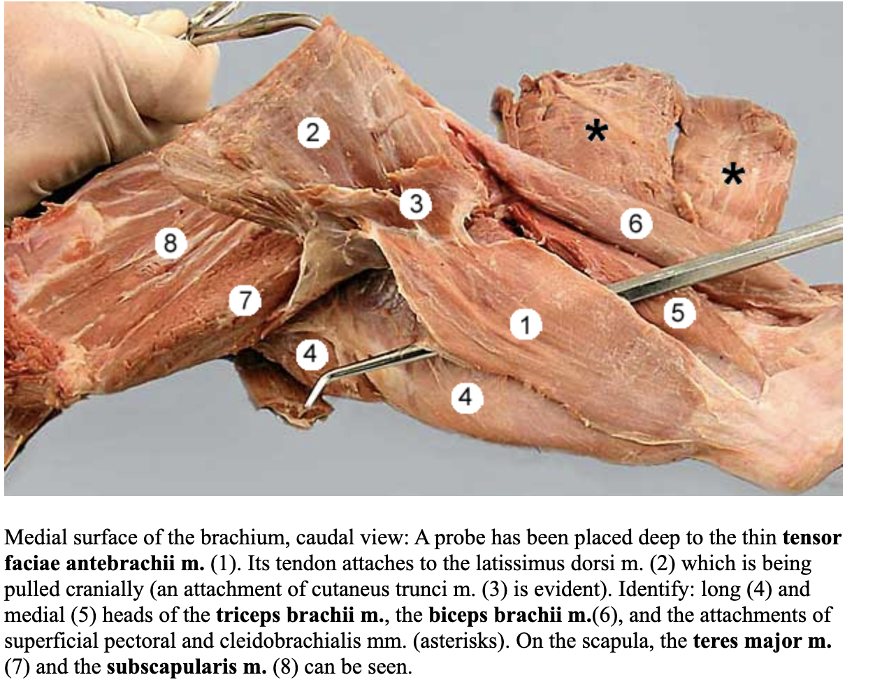 <p>attachments: fascia on the lateral surface of the latissimus dorsi and olecranon</p><p>action: extend the elbow joint</p><p>nerve: radial nerve</p><p>blood: deep brachial artery </p>