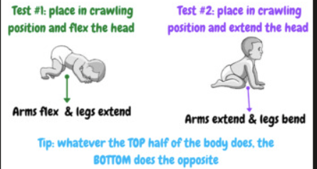 <ul><li><p>primitive reflex - brainstem</p></li><li><p>sitting/on knees, flexion of the head to chin to chest causes flexed hand and upper extremities and extension of the lower extremities,,, extension of the head causes extension of the upper extremities and flexed lower extremities</p></li><li><p>integrates at 8-12 months</p></li></ul><p></p>