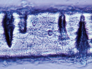 <p>Causes hair perforation</p>