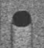 <p>Echo-free appearance, structure will be black, fluid-filled </p>