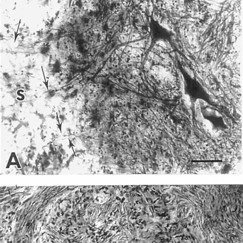 <p><em>Woerly, S., Doan, V. D., Sosa, N., et al. (2001). Holmes-stained horizontal sections of spinal cord [Photomicrograph].</em></p>