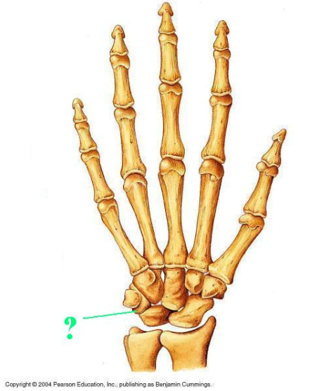 <p><span>Identify the indicated bone.</span></p>