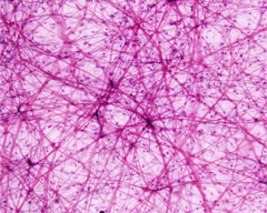 <p>component of loose connective tissue- provides tensile strength and structural support</p>