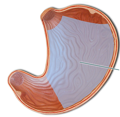 <p>tiết ra</p>