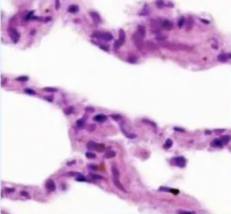 <p><strong>simple squamous</strong>: function</p>