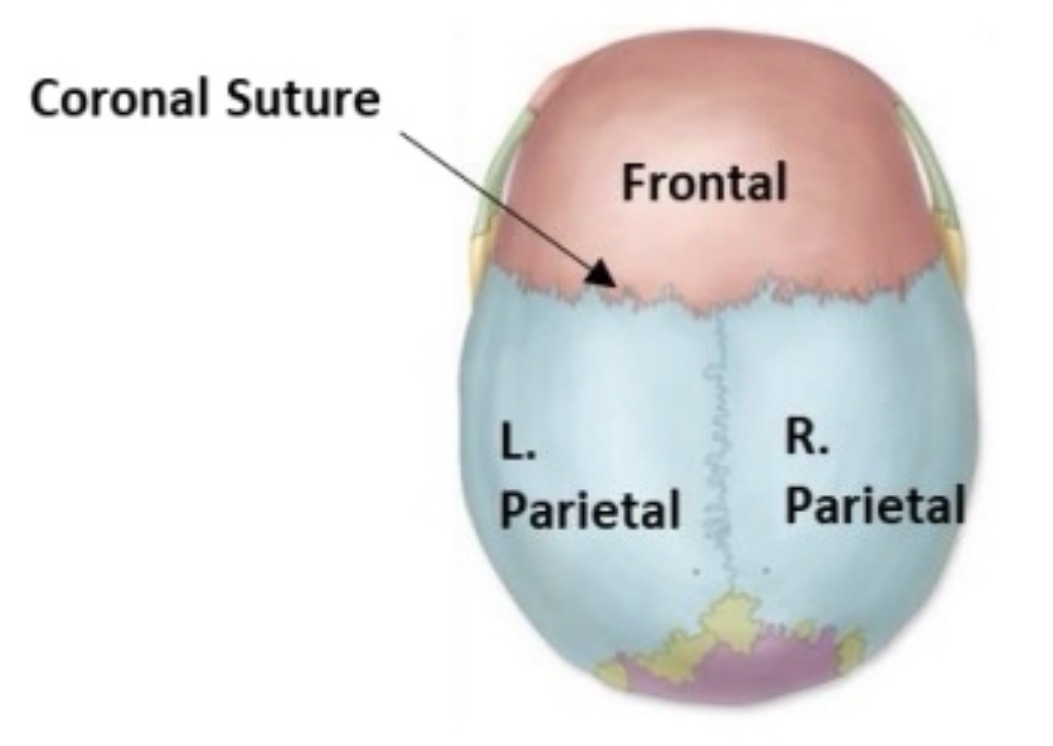 <p>coronal suture </p>