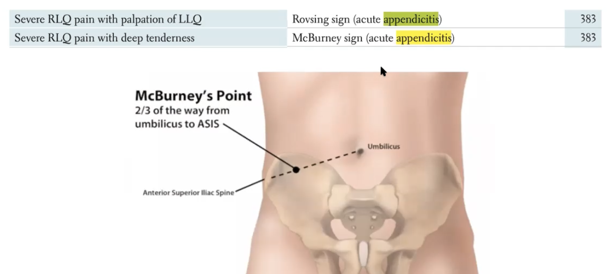 <p><u>Pathology</u>: Fecalith (adult / lymphoid hyperplasia (children)</p><p><u>Pain</u>:</p><ul><li><p>Peri-umbilical pain —→ Mcburneys point (2/3 from BB to ASIS)</p></li><li><p>Rovsing sign —> rebounding sign with palpation of the LLQ —> <strong><u>pain</u></strong> in the RLQ</p></li></ul><p><u>Sxs</u>: Nausea, vomiting, no appitite, + G/R/R</p><p><u>Tx</u>: Clinical —-» CT abdomen/US (from children or pregnant women), Boards—→ always surgery</p><p><strong><u>Chapman</u></strong><u> </u><strong><u>point</u></strong><u> (HY): </u>Tip of the 12th rib, right side</p><p><u>DDx</u>:</p><ul><li><p>Think about bladder pain ie UTI or kidney stone(more central pain)</p></li><li><p>ovary/tubes/uteruses ie torsion, cysts, PID (pelvis inflammatory disorder via gonorrhea/chlamydia travel through pelvis to pariteum) <strong>ectopic</strong> <strong>pregnancy</strong></p></li><li><p>other ie hernia, diverticulitis (usually on left, elderly)</p></li><li><p>Pseudoappendicitis - Yersinia enterocolitica (think viral gastroenteritis infection can cause RLQ pain)</p></li></ul><p>Uses this to ask target questions: LMP, back pain, ovulation (mittelschmerz pain —→middle hurts, peritoneal irritation (follicular, swelling, fallopian tube contraction), urination issues, sexual history (ie STD)</p>