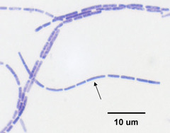 <p>rod-shaped bacteria occurring in chains</p>