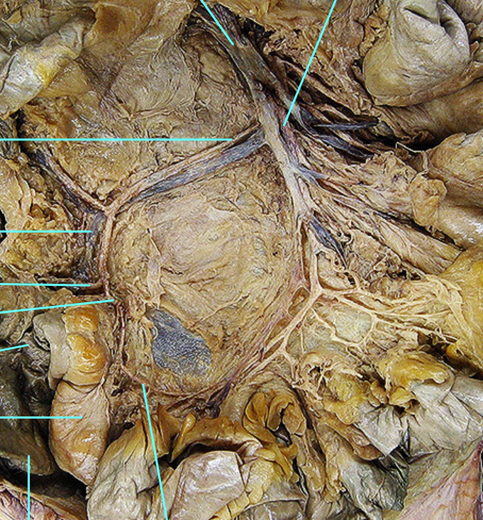 <p>Identify the structure that top blue arrow is pointing at</p>