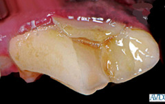 <p>What is this? What is another name for this?</p>