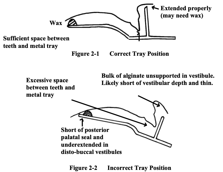 <p>Why should you avoid seating the maxillary tray in the posterior first, then anterior?</p>